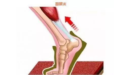 男生跟腱长度标准