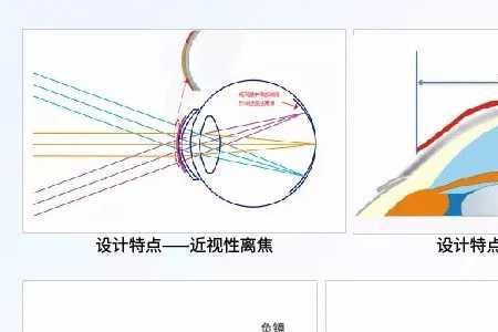 离焦镜片和点状离焦镜片区别