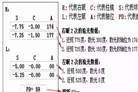 柱镜负30是什么意思