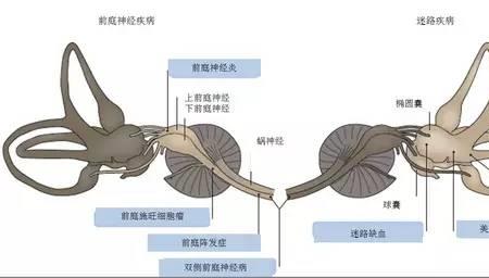 前庭窗和卵圆窗的区别