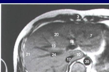 解剖学中壁面和脏面的含义