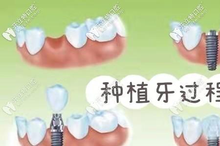 纽百特和登腾哪个贵