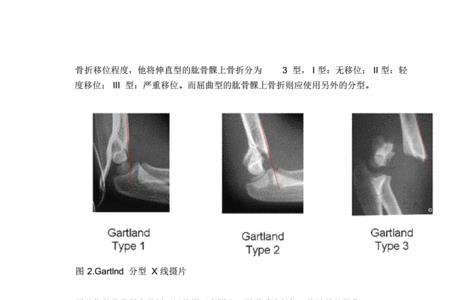 犬马之劳和肱骨之力的意思