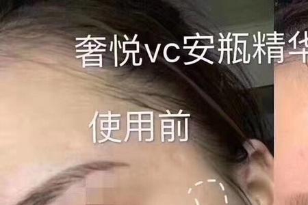 童颜纪vc安瓶怎么用