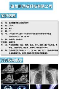 ct胶片报告正在复核中是什么意思