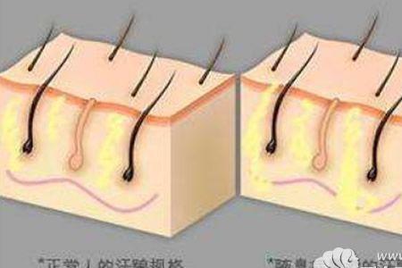 汗腺分泌的汗从哪里来