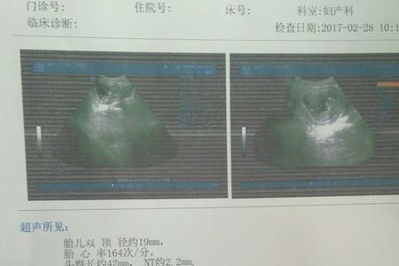 16周头臀径大概多少cm