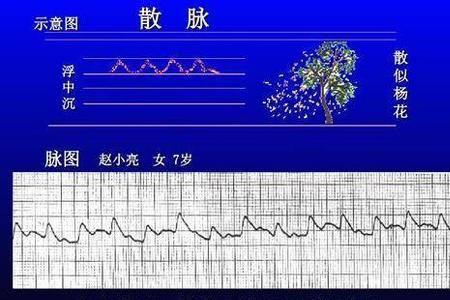 骤然失敛的意思