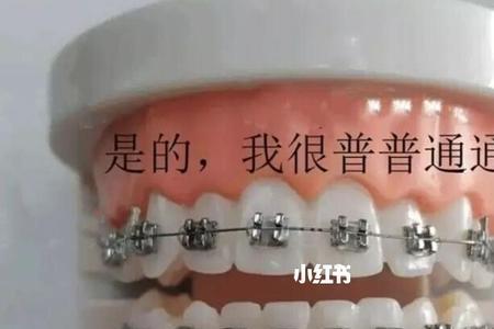 咬合力是怎么计算出来的