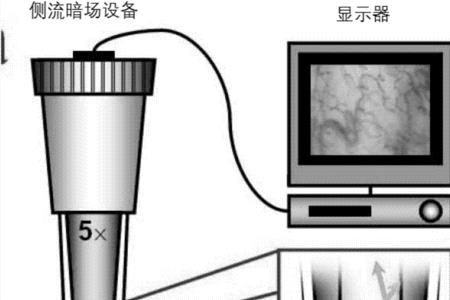 hp433a提示成像装置严重不足