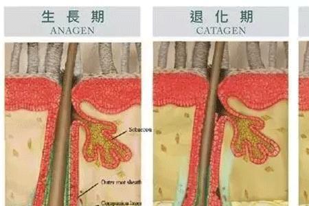 ihelmet激光生发梳使用方法