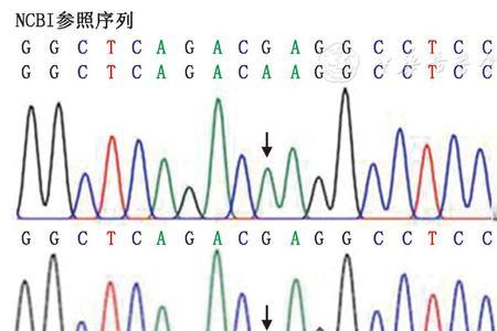 基因纯合和杂合区别