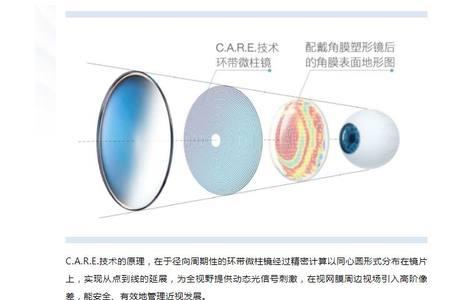 离焦镜片能戴圆框吗