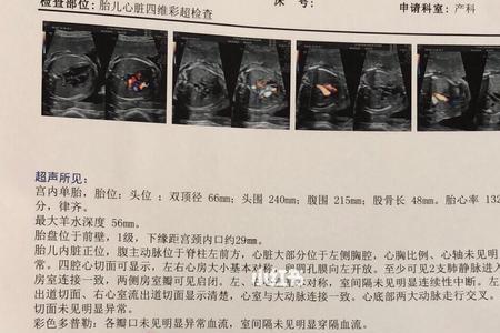 珍省心是真的吗