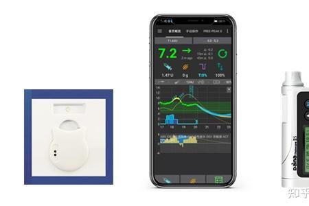 自动血糖泵优缺点