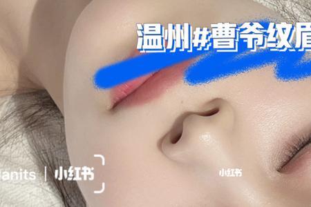 杭州哪个医院纹眉比较好