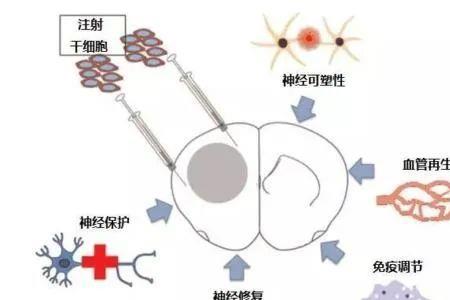 移植类创新技法可分为哪些