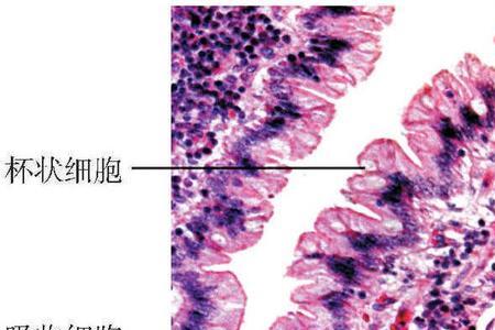 小肠机械化什么意思