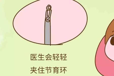 取环是什么意思