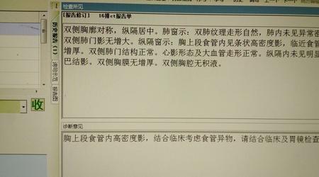 为什么ct控制室写着放气勿入