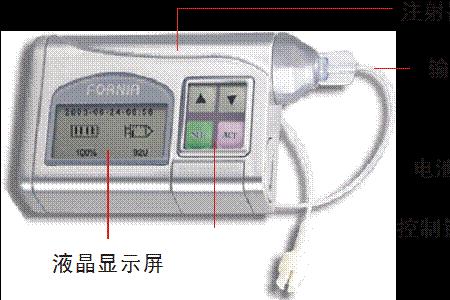 胰岛素泵报警原因及处理