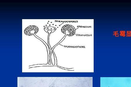 高中生物霉菌有哪几种类型