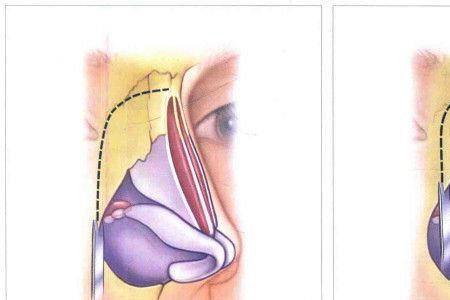 人的鼻子里面的骨头叫什么