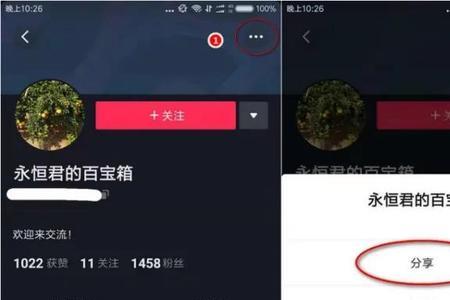 抖音怎么设置下载分享