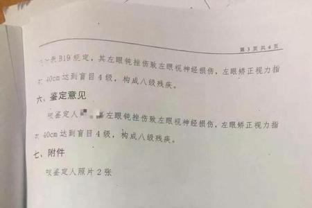 司法鉴定意见书有什么用