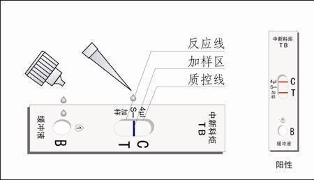 rus-chn是什么检测法