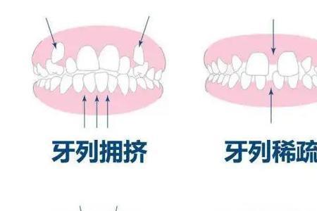 北凉四牙是哪四个