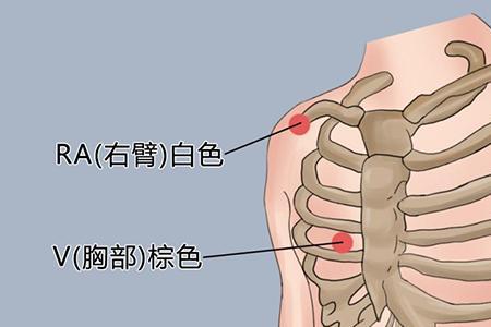 负极片的正确放置位置