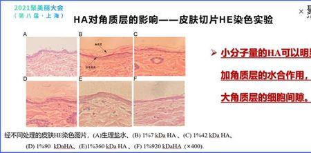 小分子透皮技术是什么原理