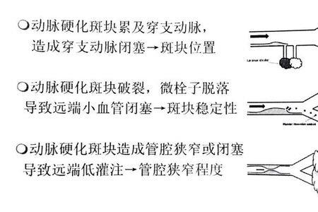 管腔和管径的区别