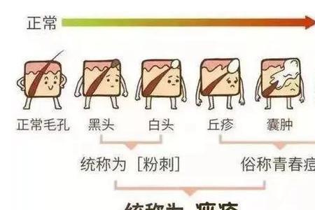 闭口和痘印有什么区别