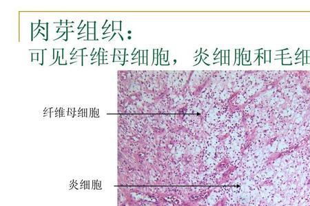 碱性纤维细胞是什么意思