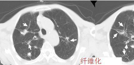 初核了结和予以了结的区别