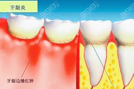 鲜红和赤红有什么区别