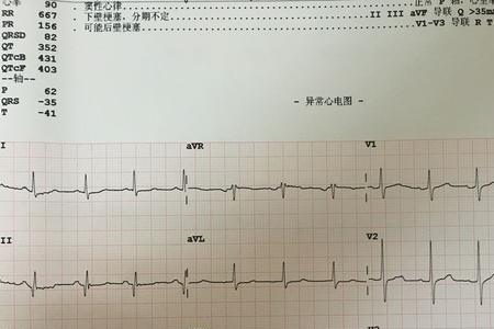 逆时针进位是什么意思