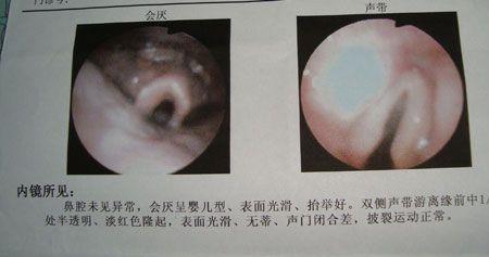 声带有几片