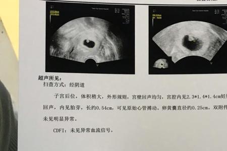 6周到8周是多少天