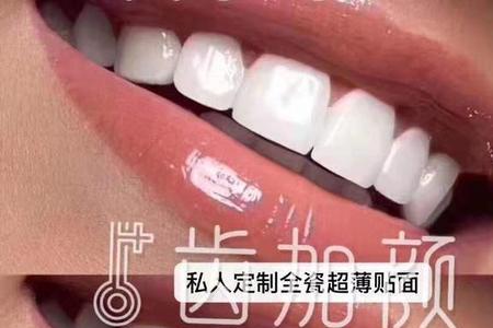 牙齿贴面广告文案