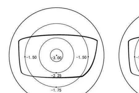 眼镜离焦和单焦点哪个更好点