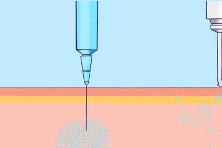 家里为什么有注射器