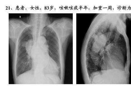 x线的质和量分别代表的是