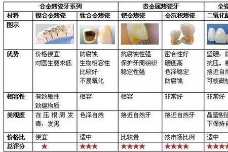 戴上全瓷牙多久才适应