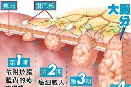 大肠表面发黄怎么清理