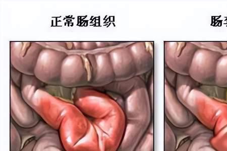 人生就像大肠包小肠