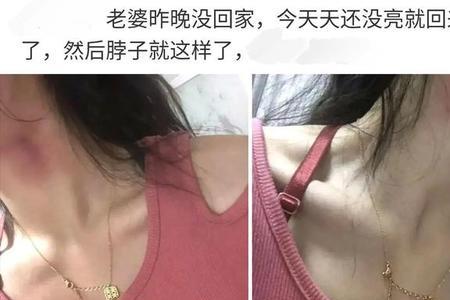 女生说你对浪漫过敏啊咋回啊