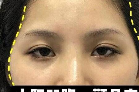 怎样判断女人颧骨高